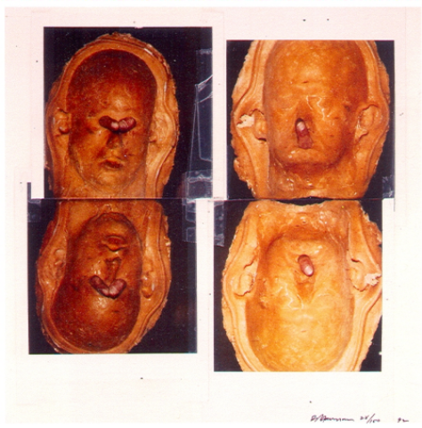 Untitled (New Museum Image), 1992